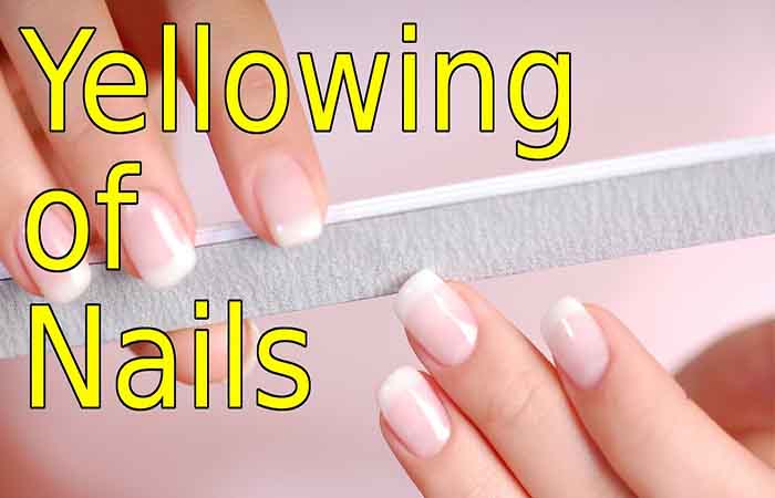 Avoiding yellow nails: preventive solutions