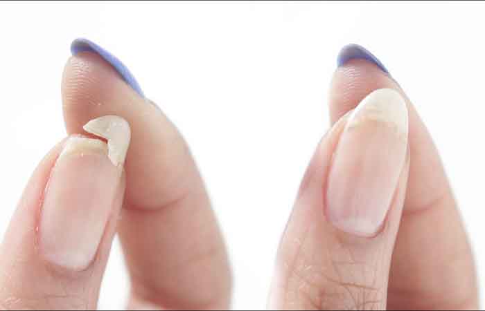Split nails: How to fix them?